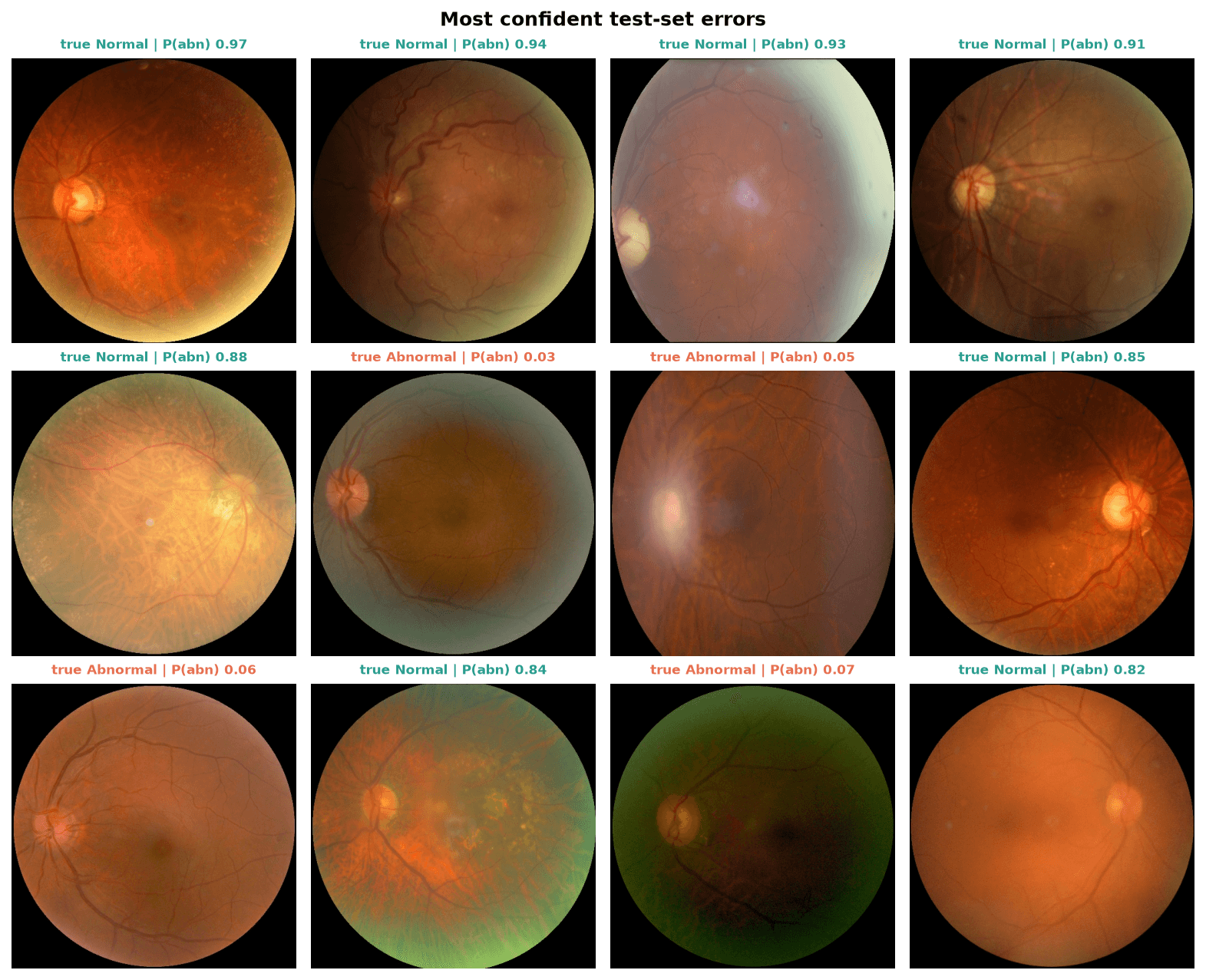 Twelve test eyes the classifier got wrong with the highest confidence